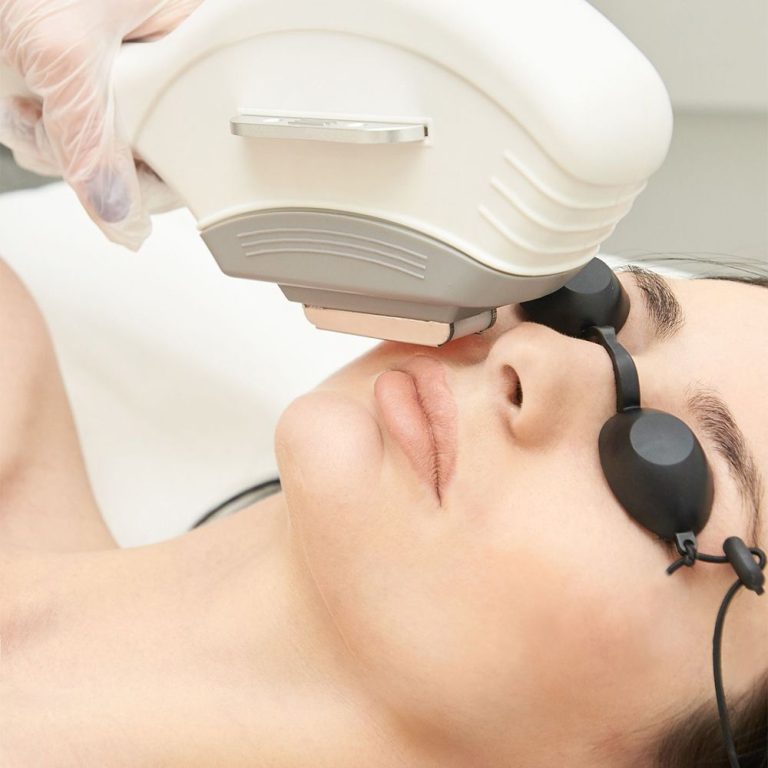 Why Is Laser Hair Removal the Most Effective Method